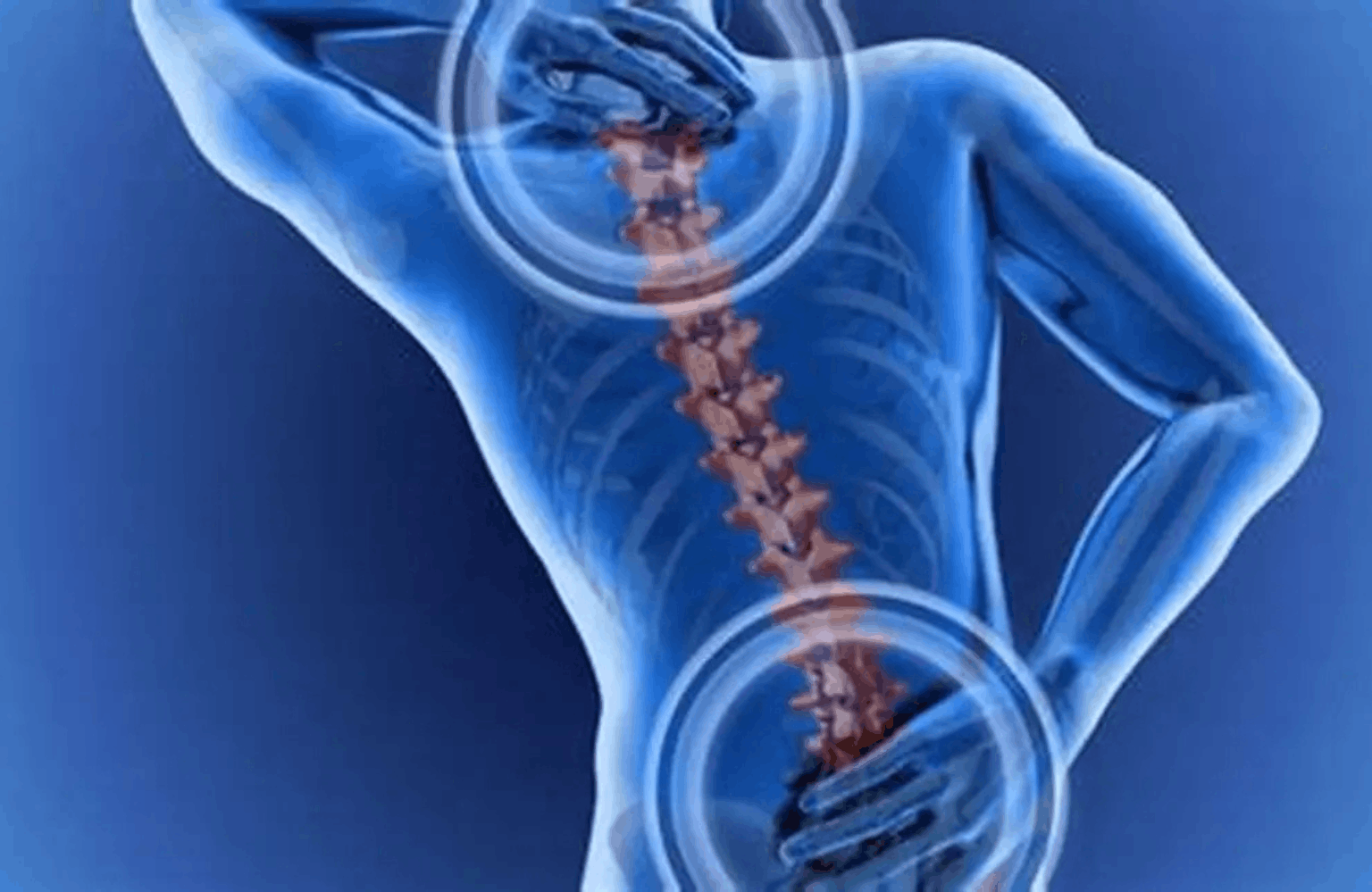 Osteoporosis Symptoms and Causes Ayurvedic Treatment | Causes & Symptoms