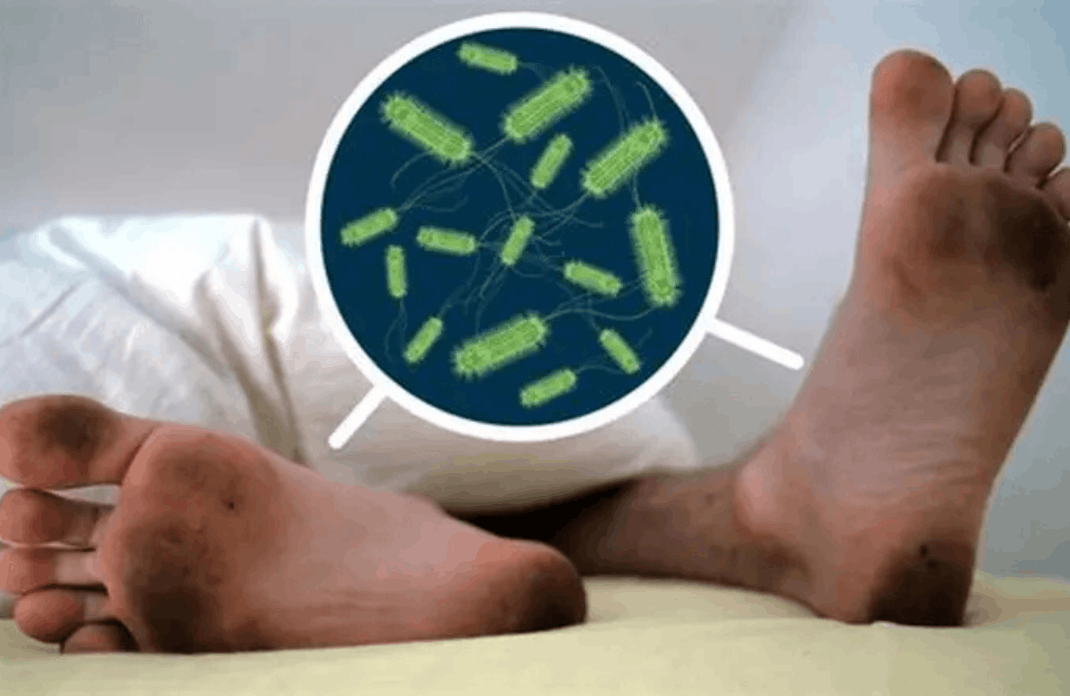Tetanus Ayurvedic Treatment | Causes & Symptoms