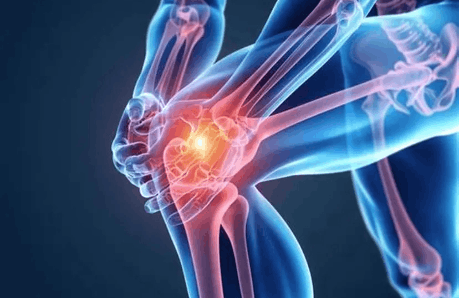 Arthritis Ayurvedic Treatment | Causes & Symptoms