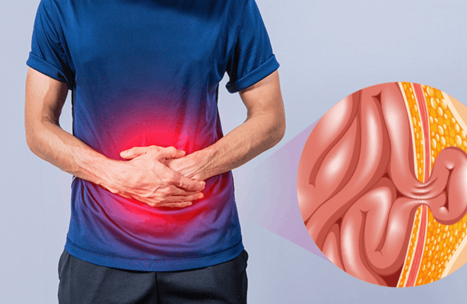 Hernia Ayurvedic Treatment | Causes & Symptoms