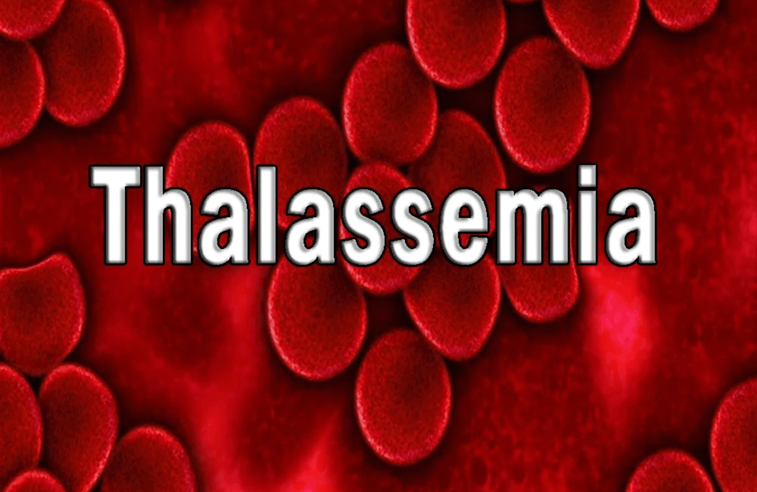 Thalassemia Symptoms and Causes Ayurvedic Treatment | Causes & Symptoms