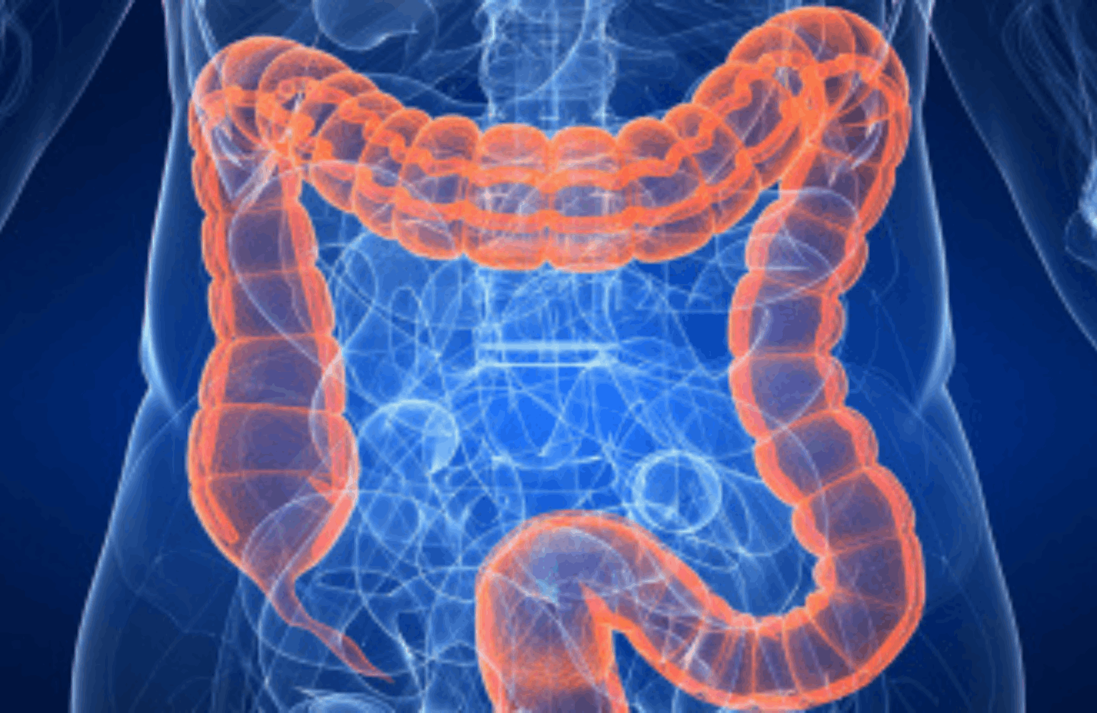 Ulcerative colitis Symptoms and Causes Ayurvedic Treatment | Causes & Symptoms